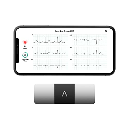 KardiaMobile Six-Lead Portable ECG Device – Fast & Accurate 6 Lead ECG Machine | US FDA Cleared & Clinically Validated Device | Record ECG at Home Safely